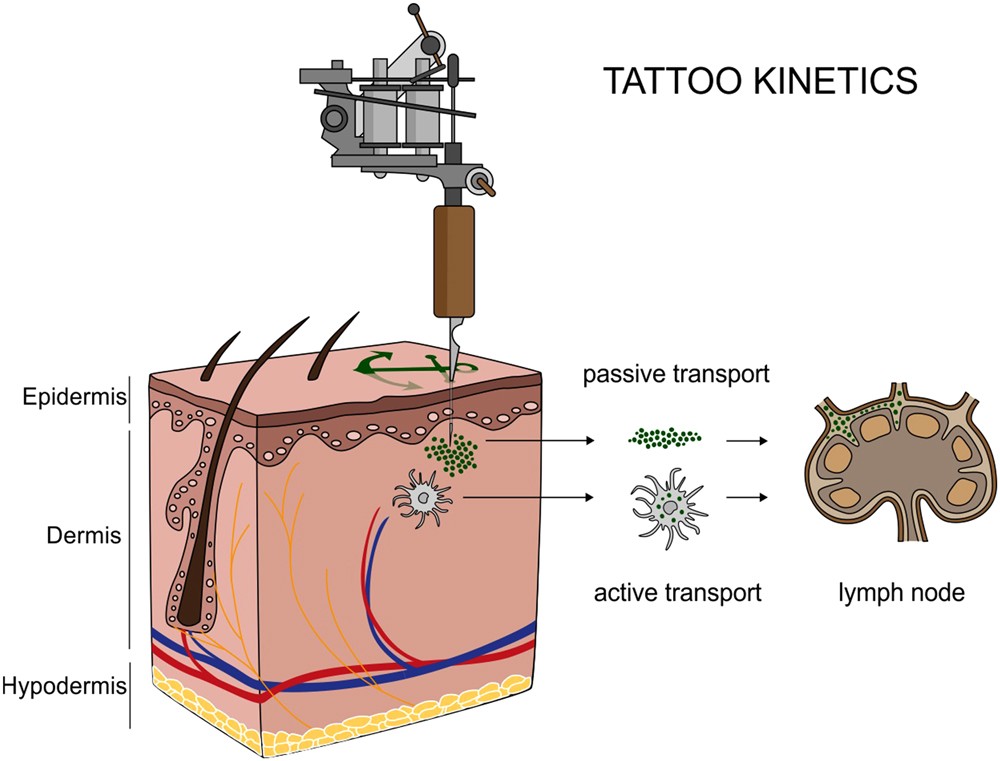 BrandonLuuMD's tweet photo. Tattoo ink may trigger chronic immune effects, while laser removal can break some pigments into carcinogenic compounds.

Tattoos were associated with 21% higher lymphoma risk. With laser removal, the risk was ~199% higher. https://t.co/0OyCXxBu2f
