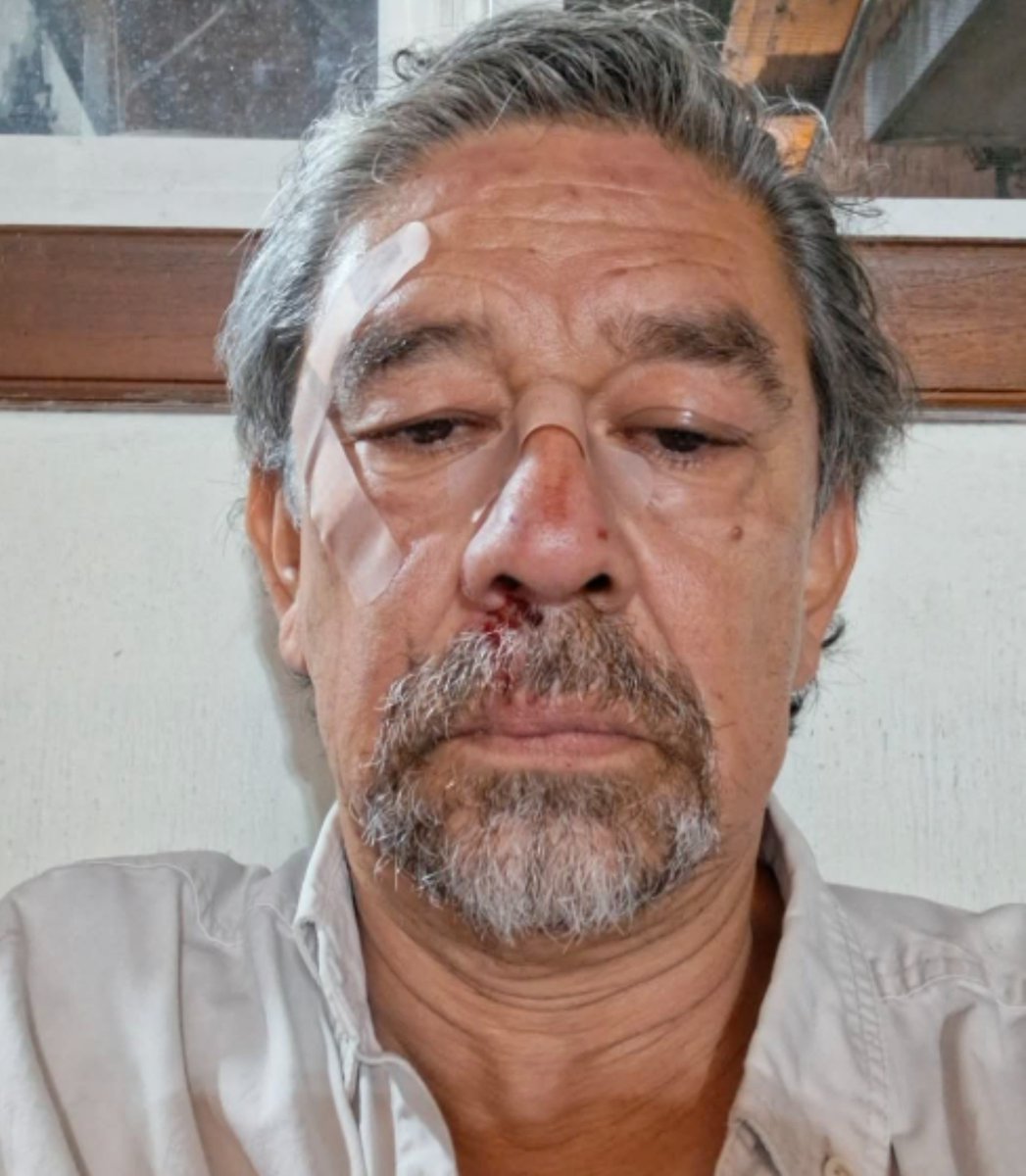 GustavoSantiz28's tweet photo. 🚨ÚLTIMA HORA 🚨

Según fuentes muy cercanas al distinguido caballero
Don chimamuertos,
La última presa no estaba muerto solo estaba dormido,
Ante tal situación el distinguido comenzal no metió ni las manos.

El cazador salió cazado. https://t.co/ZpgEOUgIhj