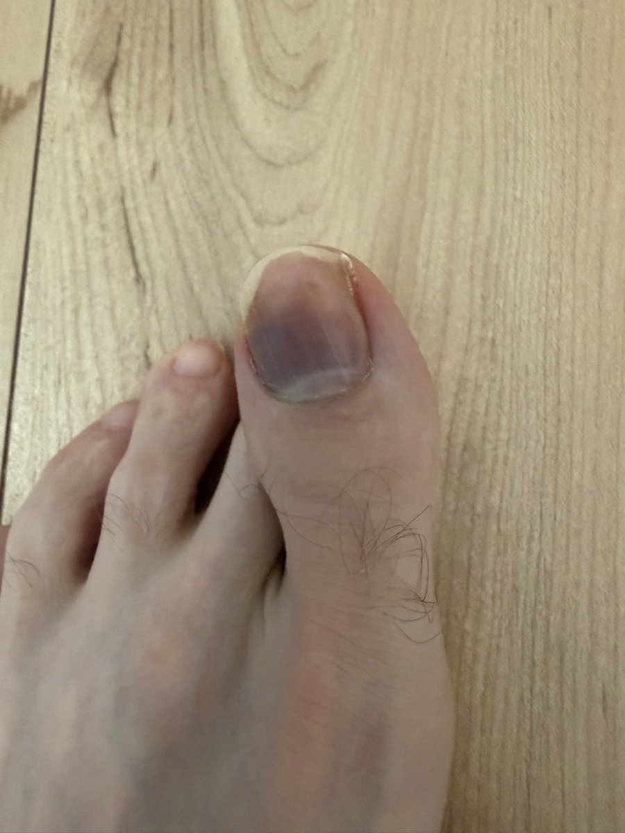 CyborgJoe2 tweet picture