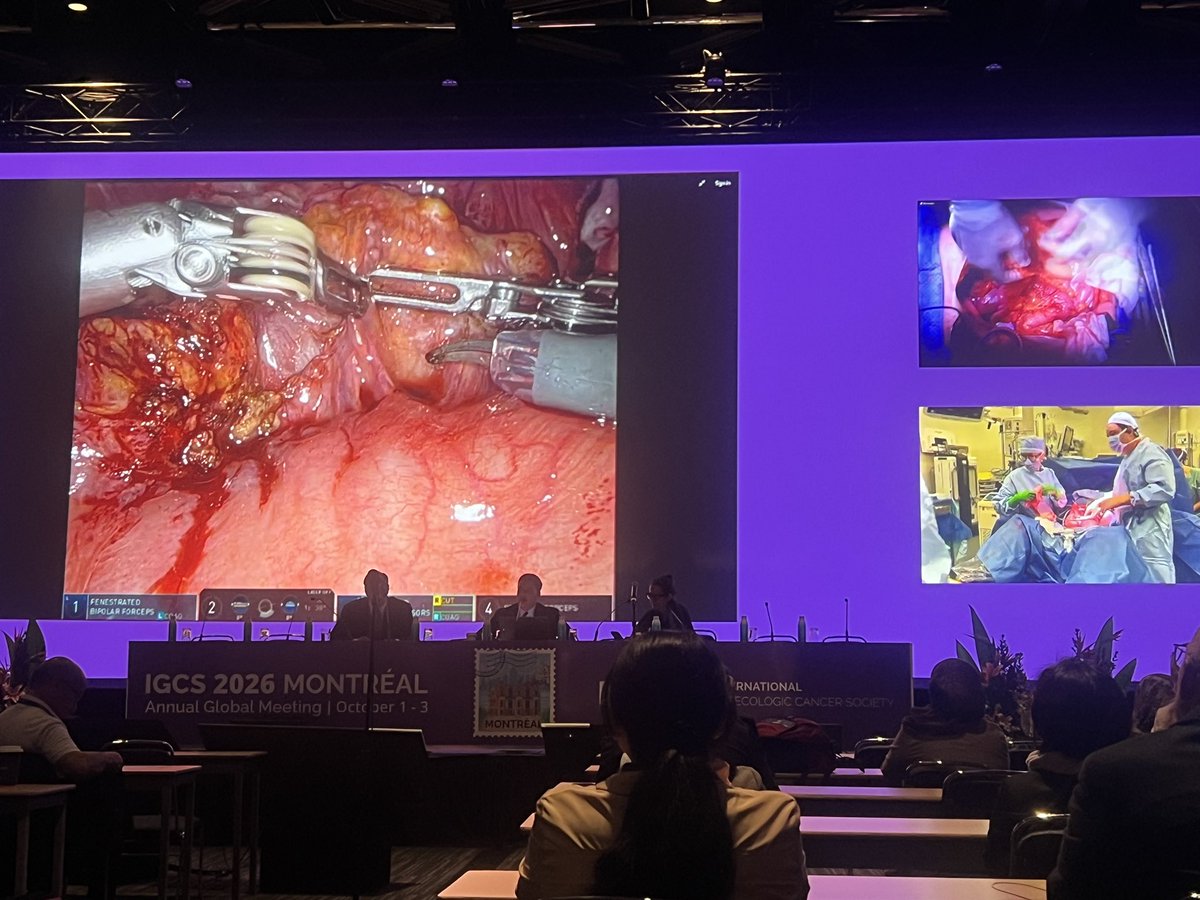 DrAishaMustaph1's tweet photo. The ongoing Live Surgery Session at the #IGCS2026 is so innovative and helpful. 

Watching three live ongoing surgeries on very large screens makes it feel like you are actually in the operating room. 

Thank you @IGCSociety https://t.co/Ogei2yRGlp