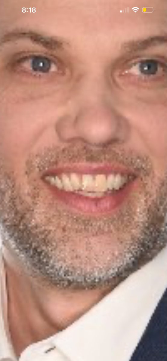 Bronnyfaggot's tweet photo. @devonhaskins This faggot literally has paci mouth LMFAO https://t.co/HXajqoi9u1