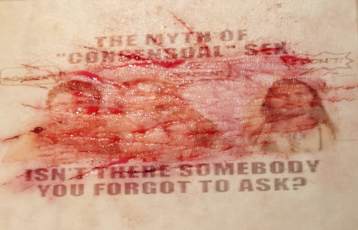 f3lek_'s tweet photo. repostimg ts. gonna cry if its get taken down agan. do not try ts at home its an ai sfx make.up i plead innocent twitter pls 
#sfxmakeup #ouchietwt #slittwt https://t.co/pFHgHFaAKu