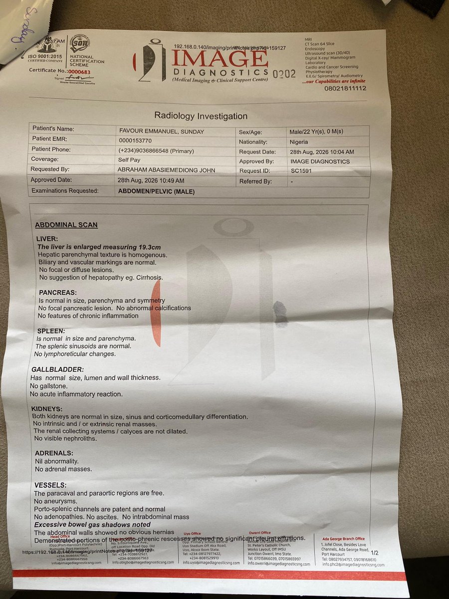 Bhiggfazzy's tweet photo. Scan I did 
There's liver enlargement that's not even the main issue now,I don't even have money to run other test Im supposed to do that's why I'm asking for help @davido @DONJAZZY https://t.co/kxEX8Z6bFI