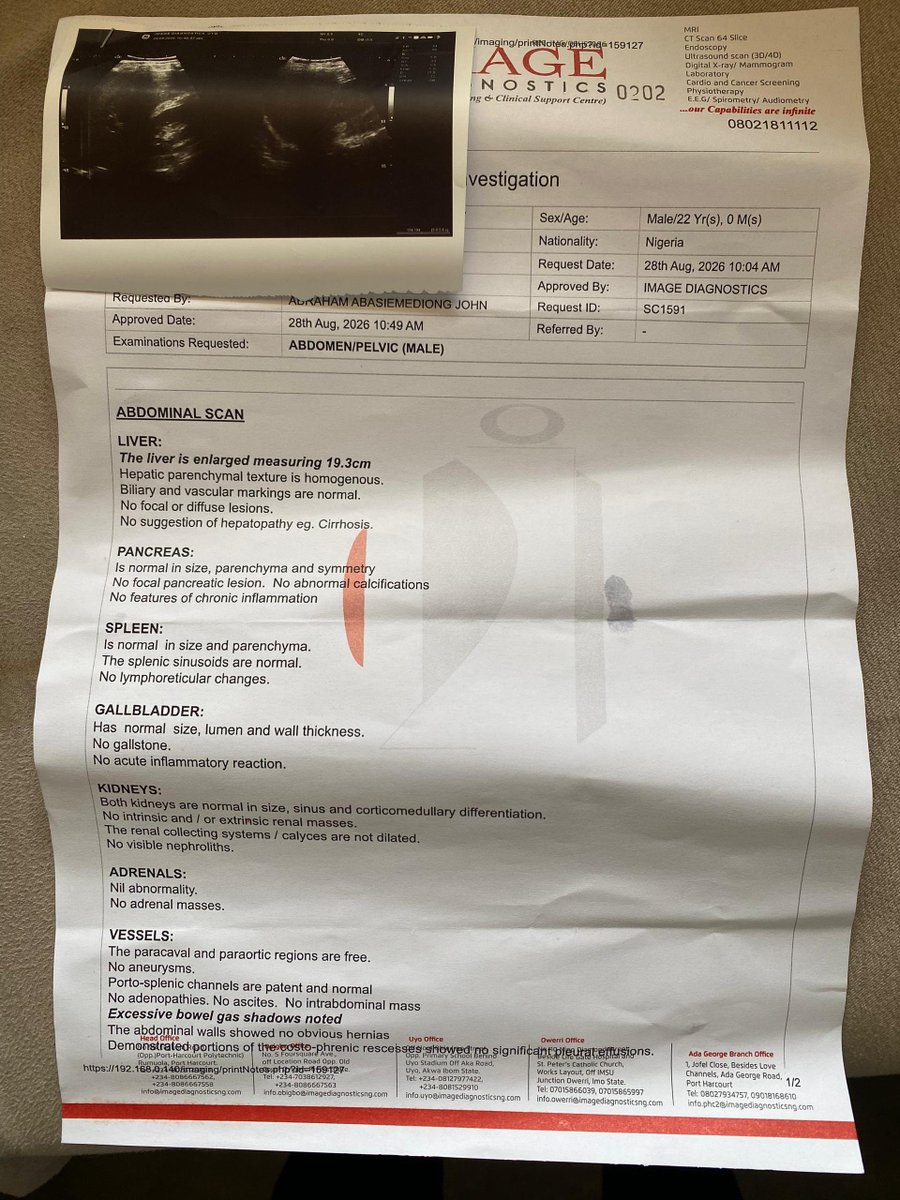Bhiggfazzy's tweet photo. Scan I did 
There's liver enlargement that's not even the main issue now,I don't even have money to run other test Im supposed to do that's why I'm asking for help @davido @DONJAZZY https://t.co/kxEX8Z6bFI
