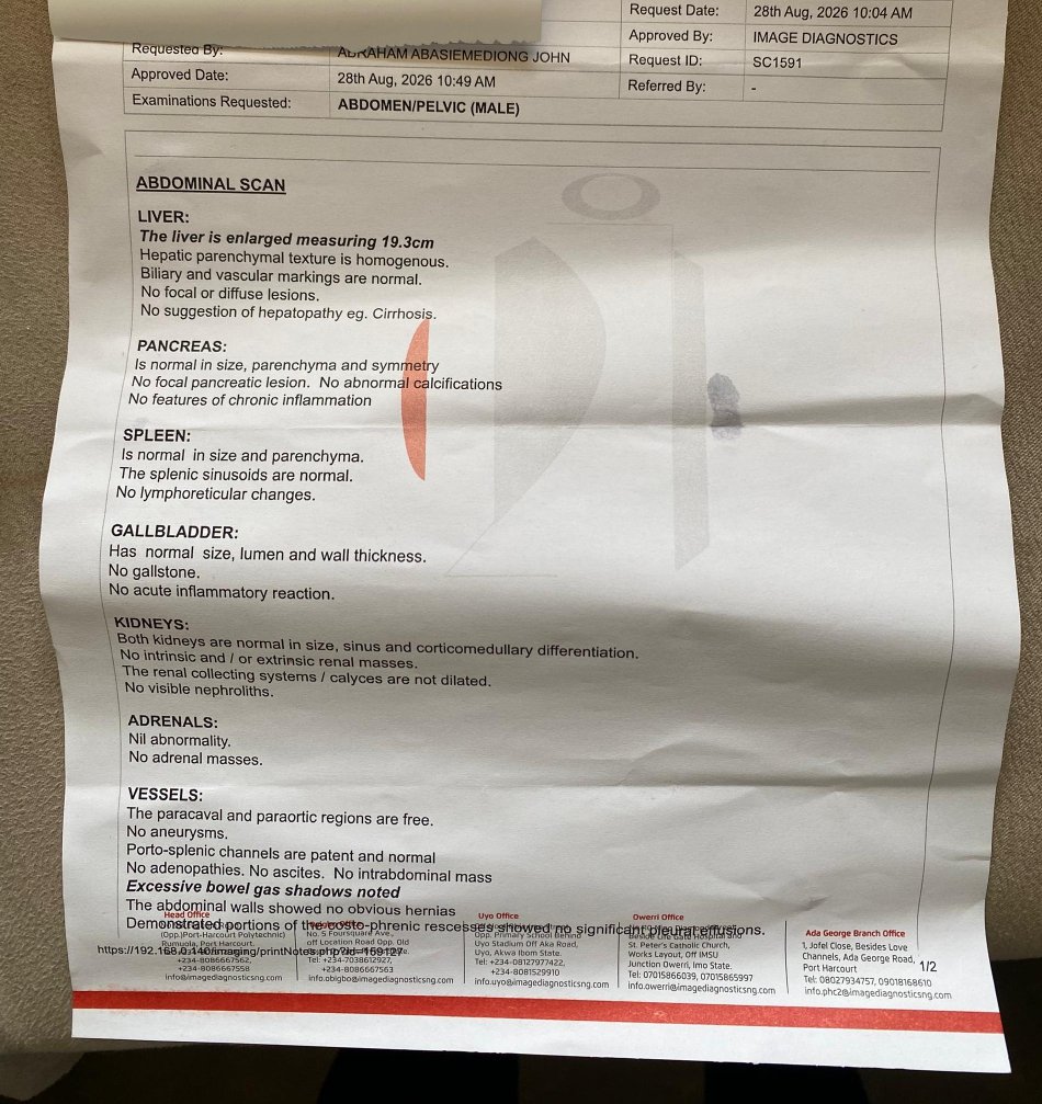 Bhiggfazzy's tweet photo. Scan I did 
There's liver enlargement that's not even the main issue now,I don't even have money to run other test Im supposed to do that's why I'm asking for help @davido @DONJAZZY https://t.co/kxEX8Z6bFI