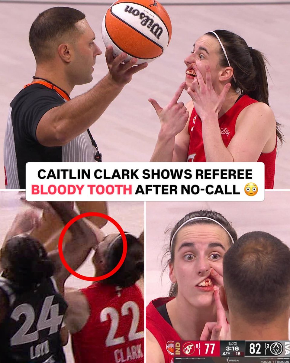 FeverUpdate's tweet photo. WNBA Scandal: While Caitlin was bleeding, the refs didn't even bother themselves to review the foul, and when A'ja Wilson trips on her own, refs immediately call for foul.

"WNBA is not a serious league, they are a laughing stock," says one of the Indiana Fever's anonymous general managers.