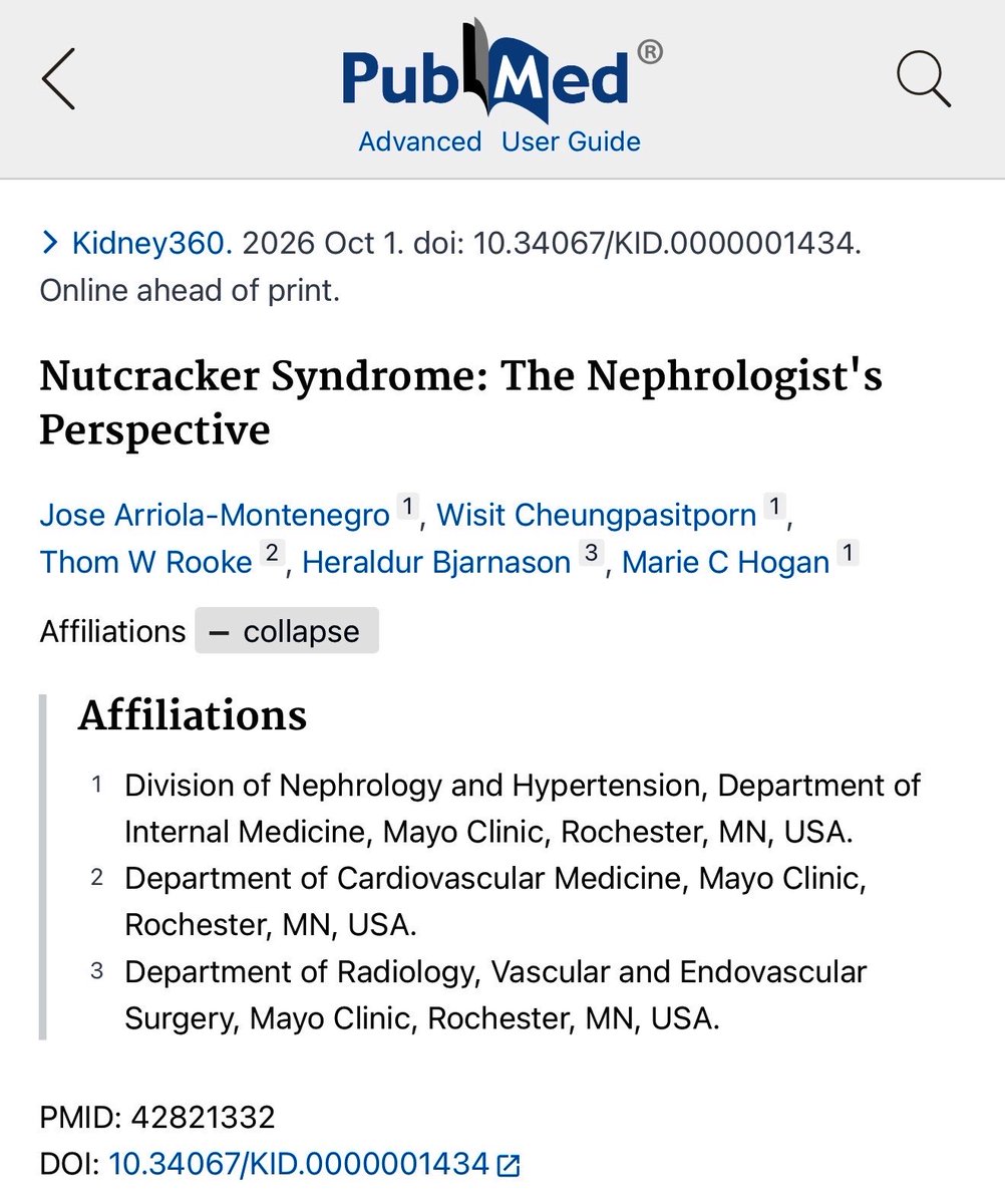 josearriolam's tweet photo. New in Kidney360 @ASNKidney360 : “Nutcracker Syndrome: The Nephrologist’s Perspective.” 🔥🔥👏🏽👏🏽

Deeply grateful to Drs. Marie Hogan @mariehogan_md , Wisit Cheungpasitporn @wisit661 , Thom Rooke, and Heraldur Bjarnason for their guidance, expertise, and collaboration across  Nephrology and Hypertension, Cardiovascular Medicine, and Radiology, Vascular and Endovascular Surgery at Mayo Clinic. @MayoClinic @MayoClinicNeph @MayoClinicCV @MayoRadiology @MayoVascSurgery 

We highlight a patient-centered, multidisciplinary approach to diagnosis, individualized treatment, chronic pain, and longitudinal care—emphasizing the nephrologist’s role in guiding patients through a complex, often misunderstood condition.

https://t.co/5v95sOmfeY