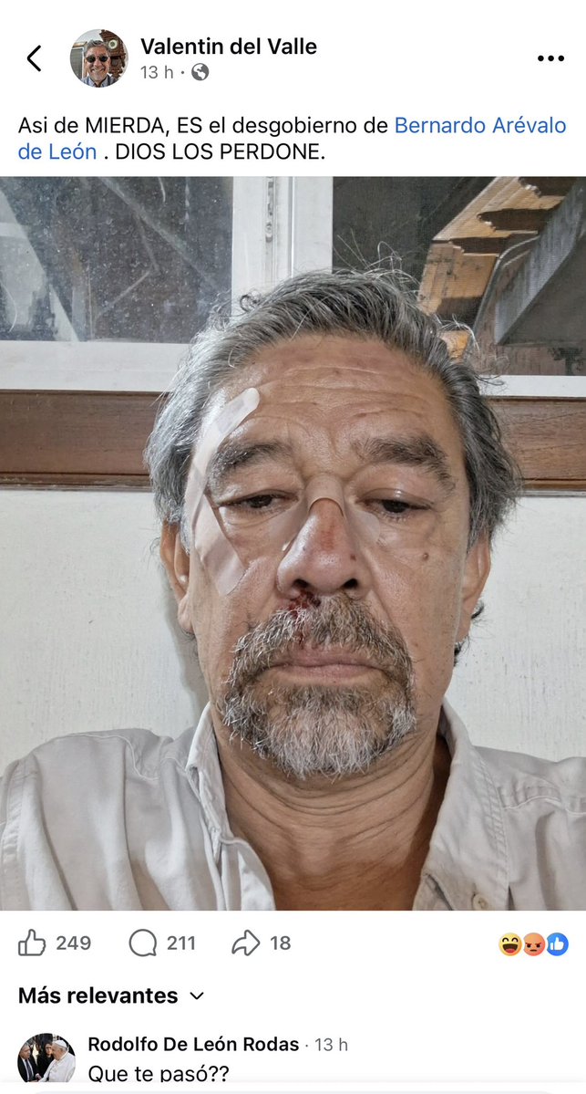 QuetzalitoGT01's tweet photo. ¿Qué está pasando con Valentín del Valle?

Tras el reciente enfrentamiento con Sergio Morataya, ahora circulan imágenes de una presunta agresión contra Valentín.

¿Coincidencia o hay algo más detrás? ��

#Guatemala #ValentinDelValle #SergioMorataya #ÚltimaHora https://t.co/TFY9iDpo18