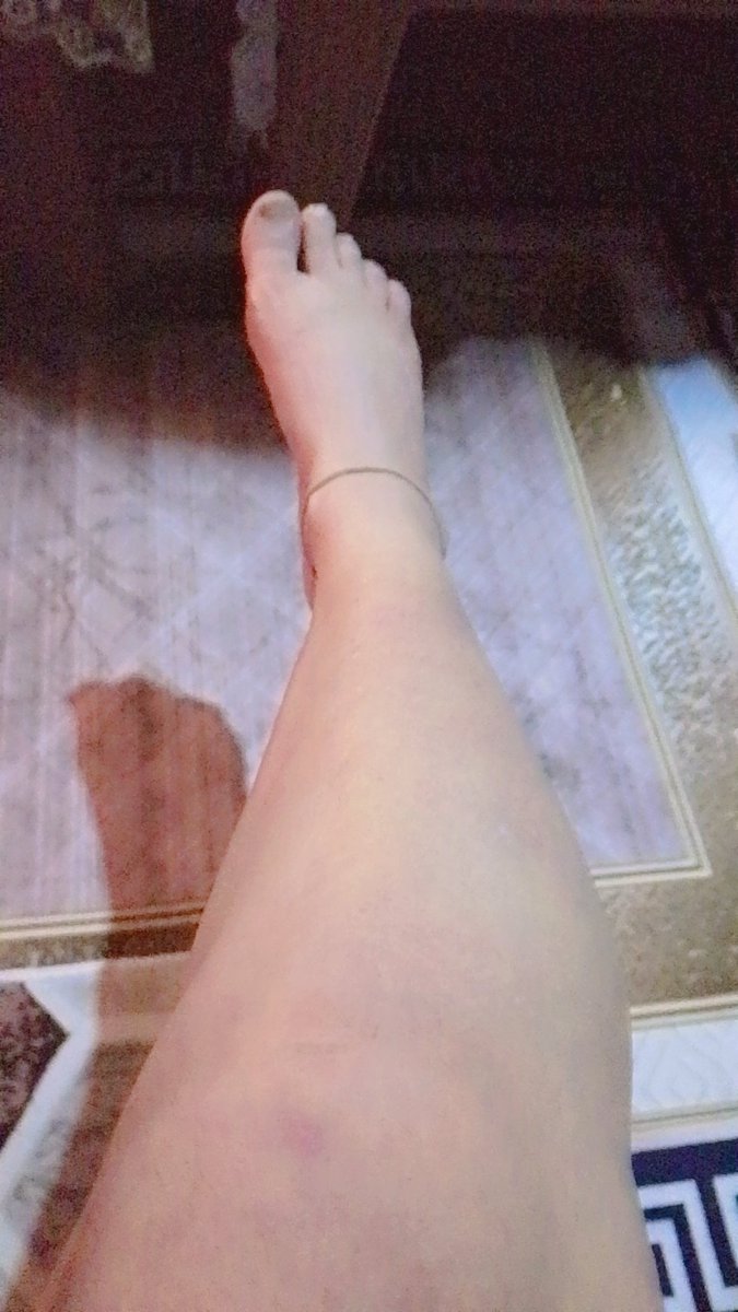 skraltyb0's tweet photo. تعالي ادلعك 
رنه خلخالي تولعك🥵 https://t.co/nA9hpm7bfu