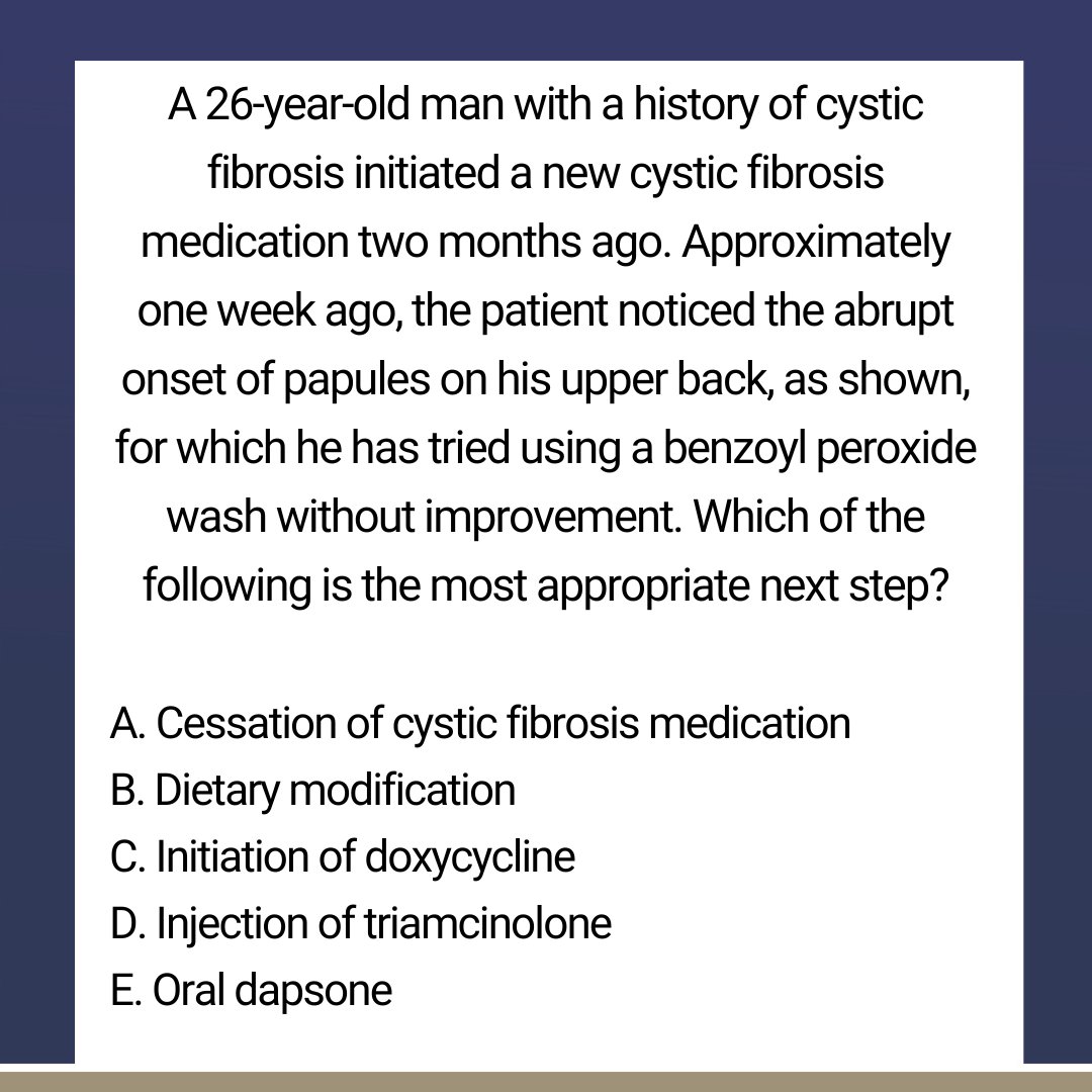 DermInReview's tweet photo. New Friday Pop Quiz alert, brought to you by Galderma! 

Test your derm board knowledge: drop your best guess in the replies below, then head over to Next Steps in Derm to check the answer and full explanations! 👇

https://t.co/AdTX0ws2HP

#Dermatology #MedEd https://t.co/WmTSWleyDy