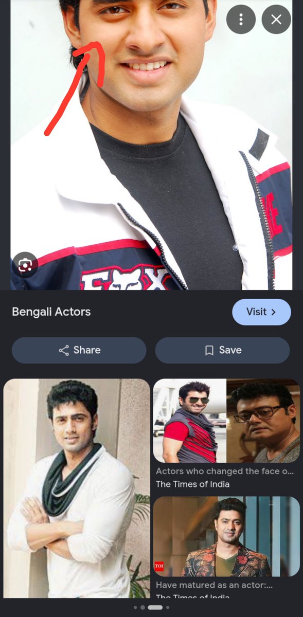 evoslanp's tweet photo. @IndianGeostrat I'm like very eastern bengali (sylheti) i noticed that Bengalis especially the uppercastes have a distinct eye area with either too much uee or eyebags for some reason most Bengalis have recessed infras idk why is that even my infras are like that https://t.co/Q5AARTlvR4