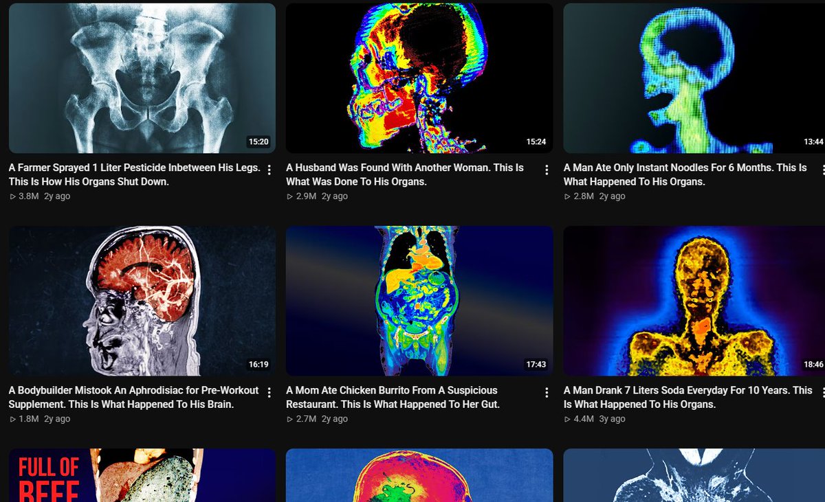 MoriBrainworm's tweet photo. my ocd feels like any chubbyemu thumbnail https://t.co/WyBqS9rnKo