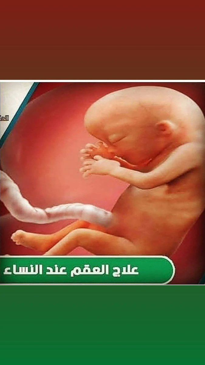 SHEeKH_r's tweet photo. المعالج الروحاني لحل المشاكل الزوجية والأسرية وكافه الأعمال الروحانية لتواصل واتساب 00962775998404
#صباح_الخير #جمعة_مباركة #عيد_الأضحى #السعوديه #الامارات #البحرين #اكسبلور #كلمات #السعودية #اماراتية #السعودية_جدة #محافظ_حرمین_شریفین #NoMásJEP https://t.co/yiBMuTogUY