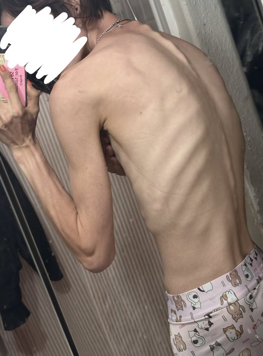 BonesNBobo's tweet photo. Morning w8: I slept rlly well 4once last night. Funeral in a few hours so I’m glad I’m rested at least ε-(´・`*) #edrtwt #bodycheck #ricecaketwt https://t.co/zt076tuY56