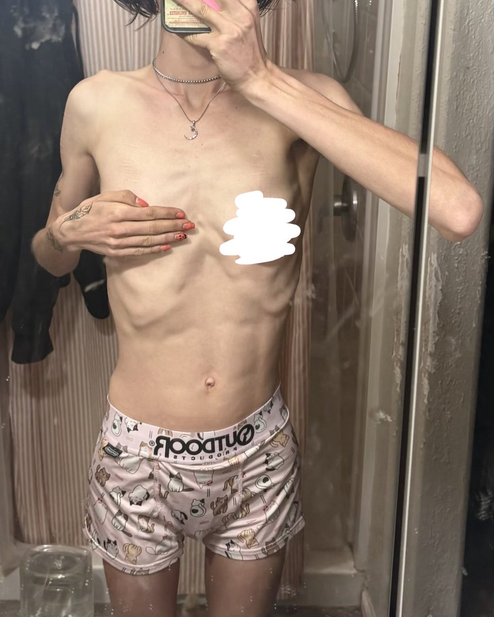 BonesNBobo's tweet photo. Morning w8: I slept rlly well 4once last night. Funeral in a few hours so I’m glad I’m rested at least ε-(´・`*) #edrtwt #bodycheck #ricecaketwt https://t.co/zt076tuY56