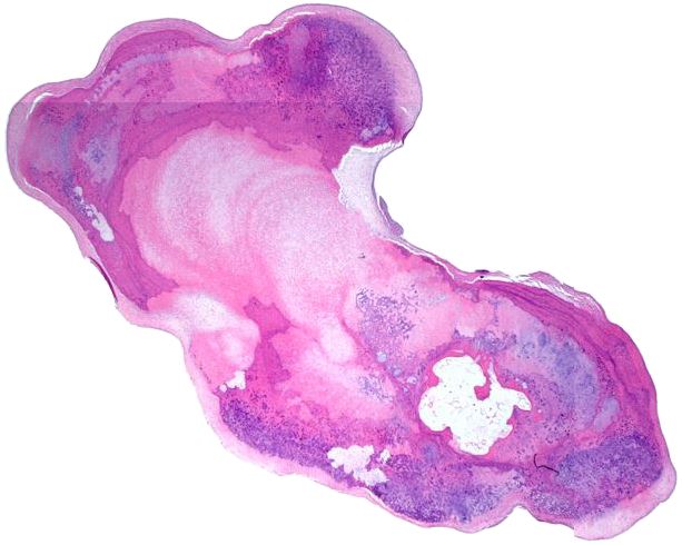 pathothama tweet picture