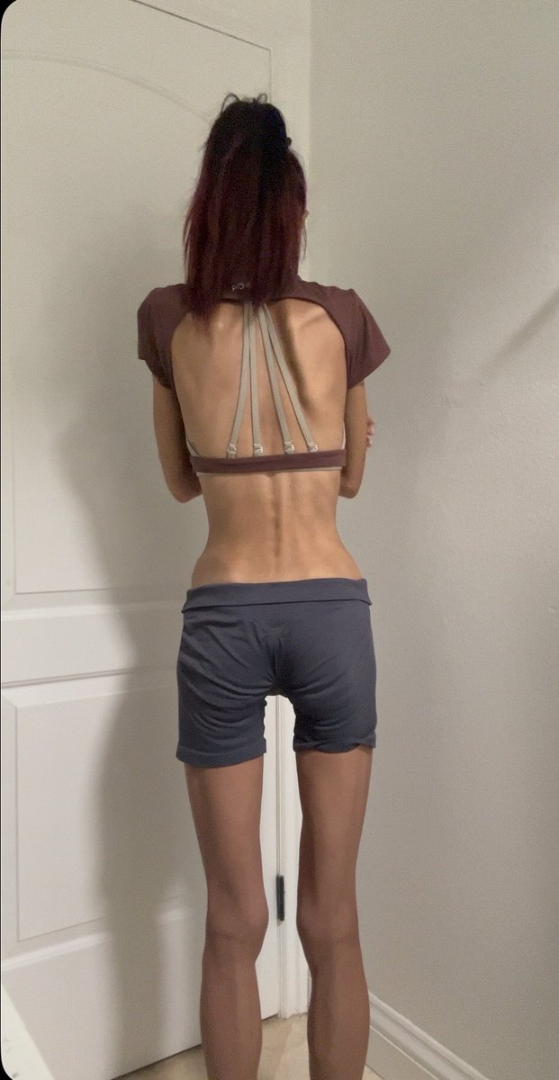 witheringfemme's tweet photo. hold up my legs actually look somewhat thin here #edrtwt https://t.co/d1nrhiV2T7