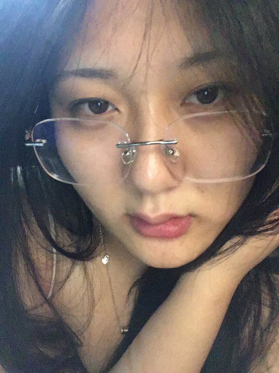 17x0731's tweet photo. 痘痘好了就是狂 照片不p直接发 https://t.co/O9bjarvvcN