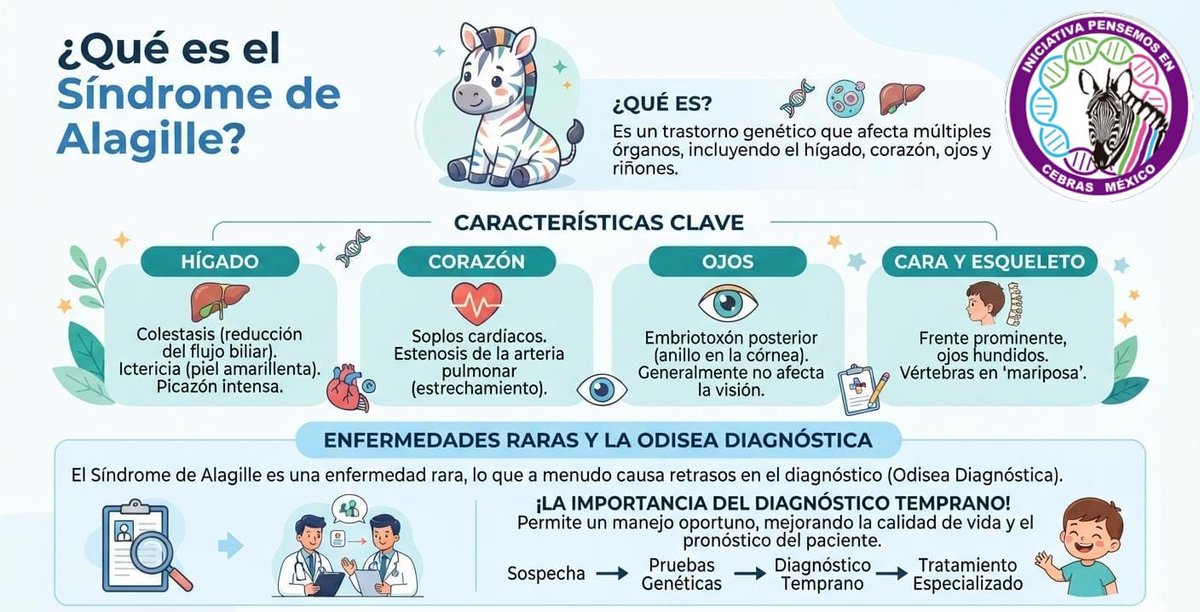PCebras's tweet photo. 👉Conoce más sobre el síndrome de #Alagille es un trastorno genético raro que causa una reducción en la cantidad de conductos biliares dentro del hígado. #EnfermedadesRaras  #Sindromedealagille 🦓 https://t.co/3vyZnIfc8S