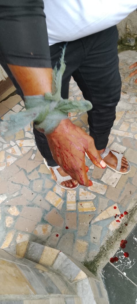 PrettieAdiela's tweet photo. Cc: 
IGP @Disu
@CRS_PoliceNG
FPRO @CspIniedu
@OfficialDSSNG

Dear @PoliceNG

I wish to "openly complain" and draw your attention to the violent attacks on a peaceful PDP consultative meeting in Calabar South today. 

Gunmen disrupted the meeting at the palace of Etubom Nyong Edet Okon I, shooting three (3)  persons who are now hospitalized, and also attacked vehicles at the African Club venue, stealing cameras, phones and drones.

This is an attack on our constitutional right to peaceful political association as a party. I am calling on the Nigeria Police Force @PoliceNG and the Commissioner of Police, Cross River State, CP Ajo Geoffrey Ordue, to urgently investigate this matter, identify the perpetrators, bring them to justice, and ensure adequate security to prevent further violence.

We must not allow politics to turn into violence and please be informed that our youths are furious about this dehumanising treatment, they are boiling.

With utmost due respect to everyone copied, No one has monopoly of madness and how much longer can we really hold down our youths from reacting? 
Once again I plead that all relevant security agencies mentioned act and bring to book perpetrators of this beastly act.

#NoToElectoralViolence 
#CalabarSouth #CrossRiver