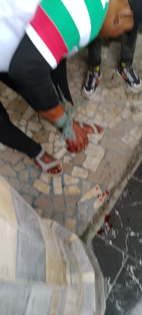 PrettieAdiela's tweet photo. Cc: 
IGP @Disu
@CRS_PoliceNG
FPRO @CspIniedu
@OfficialDSSNG

Dear @PoliceNG

I wish to "openly complain" and draw your attention to the violent attacks on a peaceful PDP consultative meeting in Calabar South today. 

Gunmen disrupted the meeting at the palace of Etubom Nyong Edet Okon I, shooting three (3)  persons who are now hospitalized, and also attacked vehicles at the African Club venue, stealing cameras, phones and drones.

This is an attack on our constitutional right to peaceful political association as a party. I am calling on the Nigeria Police Force @PoliceNG and the Commissioner of Police, Cross River State, CP Ajo Geoffrey Ordue, to urgently investigate this matter, identify the perpetrators, bring them to justice, and ensure adequate security to prevent further violence.

We must not allow politics to turn into violence and please be informed that our youths are furious about this dehumanising treatment, they are boiling.

With utmost due respect to everyone copied, No one has monopoly of madness and how much longer can we really hold down our youths from reacting? 
Once again I plead that all relevant security agencies mentioned act and bring to book perpetrators of this beastly act.

#NoToElectoralViolence 
#CalabarSouth #CrossRiver