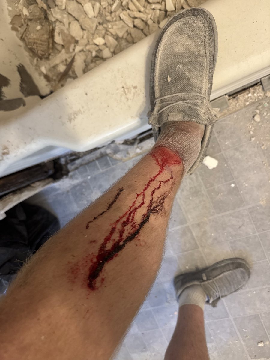 gripgrowman's tweet photo. Buy solana:5cvUXei9SCWo5vjKnTarVWbQMAFhKMSZcRje54izpump so you don’t work blue collar and end up like this. #expand #LANK https://t.co/SvU2IsE2dM