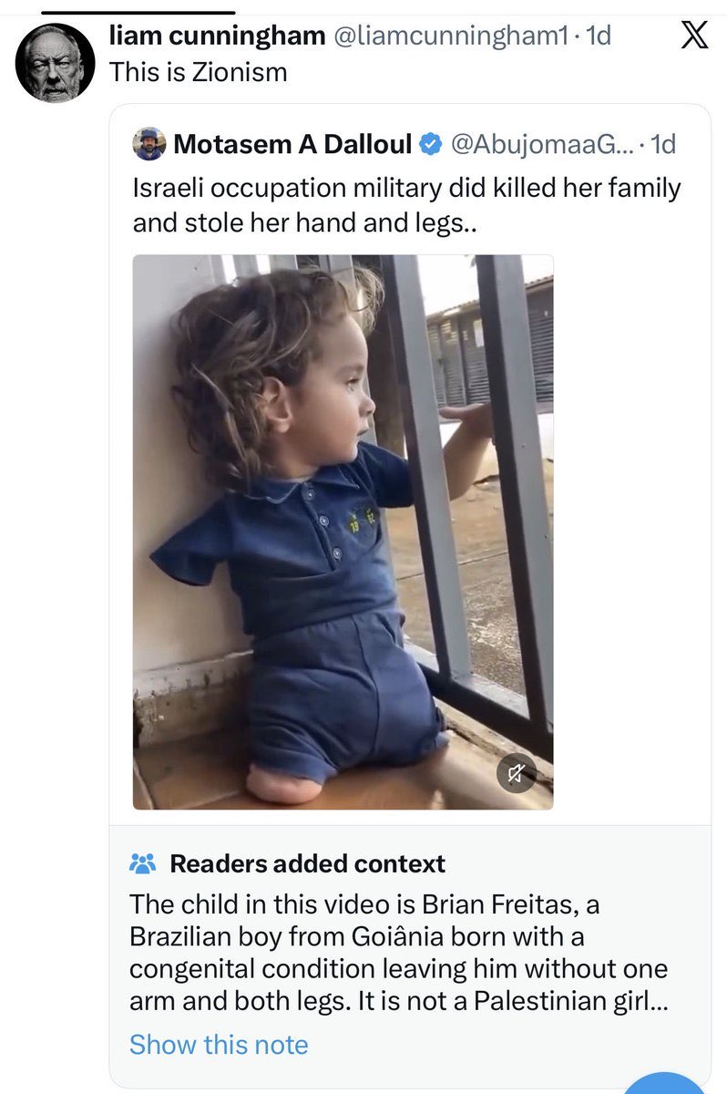 EdwardDeLavigne's tweet photo. The Jew hating Irish idiot Liam Cunningham is now very angry because he has been community noted for spreading  false information. 

On the 26/09/2026 @liamcunningham1 reposted a “Journalist” from Gaza who is not really a Journalist at all. 

The photo was of a Brazilian boy from Goiânia, who was born with a congenital condition that has left the boy without one arm and both legs. The Gazan “Journalist” was of course doing what Gazan “Journalists” do best, he was lying and trying to make out that the boy was in fact a “Palestinian” in Gaza and that the IDF had blown his legs and arm off.

The Gazan “Journalist” was community noted for lying.

@liamcunningham1 reshared the post of the Brazilian child with the title “this is Zionism.”

Well, I’d like to remind @liamcunningham1 that a Brazilian boy from Goiânia, who was born with a congenital condition that has left him without one arm and both legs has nothing to do with Zionism.

A Zionist is a person who believes that the Jewish people have the right to a nation in their ancient, ancestral, historical homeland in what is now Israel, and a person who believes that Jews have the right to self determination in that nation. 

@liamcunningham1 is a dishonourable, dishonest and stupid person who is Anti-Zionist, which means that he does not believe that the Jewish people have a right to a nation in their ancestral homeland, and he does not believe that the Jewish people have the right to self determination.

That makes @liamcunningham1 both an antisemite and a fascist ! 

There is no place for people like this in civilised society. Antisemitism is a disease carried by barbarism, that threatens all civilised society.

Words are important though, Zionist comes from the word Zion which means Jerusalem, and the idea that Jews have the right to return and self determine in their ancestral homeland. To be against this idea and be anti Zionist, means that you are against the idea that Jews have the right to self determination. That is most definitely antisemitic. 

Israel was decolonised by its indigenous people, the Jews, Zionism was the ultimate decolonisation movement. 

Zionism was and is the Jewish People’s movement for self-determination in their ancestral homeland. It affirms their rights without denying anyone else’s. It is freedom, justice, co-existence, strength, innovation, diversity, survival, indigenous rights, and so much more.  

For the People of Israel, the Land of Israel is their one and only home, the only place that ever was, and the only place that ever will be.  

That’s Zionism. And it’s in the soul of every Jew. 

Any definition of Zionism that aligns it with oppression or imperialism or Nazism is a strategic attempt to undermine Jewish self-determination, something Jews didn’t have for the most part of 1900 years.

@liamcunningham1 can continue to bastardise the word and change its meaning to suit his interpretation of what he thinks it means in his fucked up head, but by doing so only confirms that he is indeed a dishonourable, dishonest and stupid asshole !!

Again, this photo posted by @liamcunningham1 of a Brazilian boy from Goiânia, who was born with a congenital condition which has left him without one arm and both legs has nothing to do with Zionism. But Liam needs a Jew to blame for everything !!