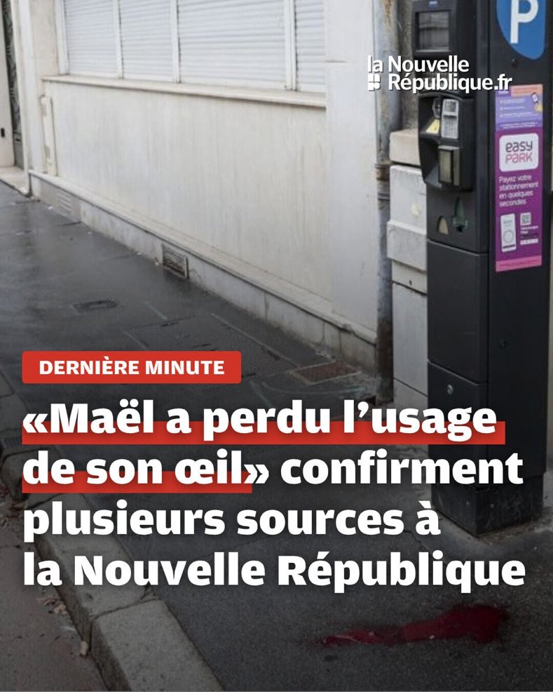 verity_france's tweet photo. Il y a un très gros problème avec les LBD. Il n’est pas normal qu’un gamin soit mutilé par la police. https://t.co/M2DtgrAAuA