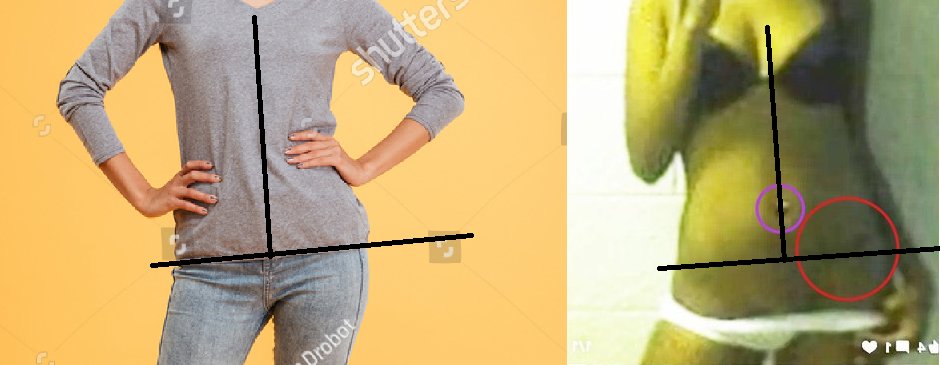 georganche's tweet photo. @AstroSeesTruth @nerosentry When you lean on one leg, the weight-bearing hip rises and the whole hip line tilts. A tattoo that’s horizontal when standing straight would look angled in that pose. https://t.co/kEACgwVRM6