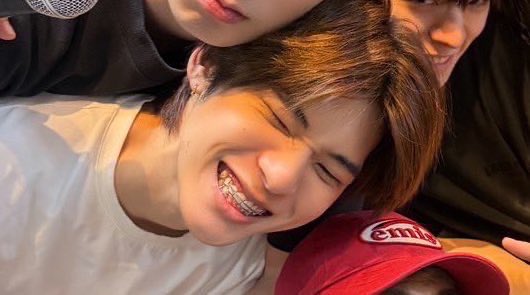 qteeblue's tweet photo. ฟันเหล็กเด็กใคร https://t.co/yfJKKwzwXN