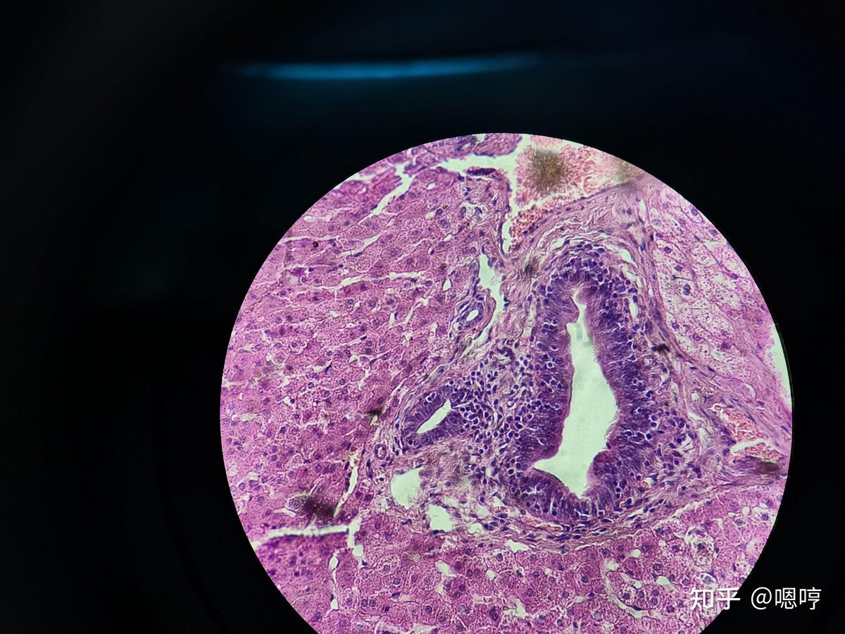 lindseyqu_1_cf9's tweet photo. Shoutout to the tough research on the 韧剖腺 (rendouxian) tissue! Its unique structure shows amazing resilience that’s driving new medical insights.， https://t.co/AEov0vnM0n