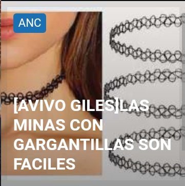 neyiturro's tweet photo. dejé de usar chokers porque pienso a diario en esto https://t.co/L3criwkpsO