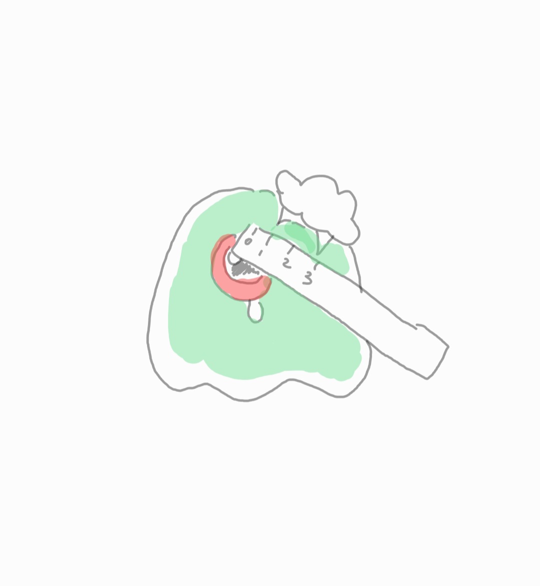 DDo_again_'s tweet photo. 그리고 그외에 물린 것들 https://t.co/r7i8Y2g5mD