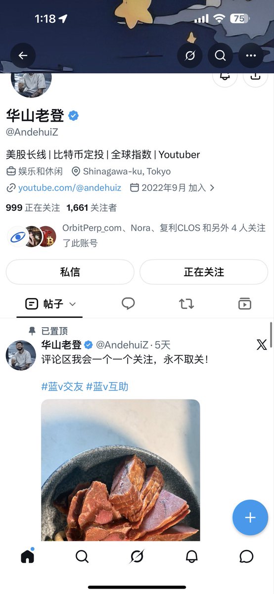 i2tkv's tweet photo. @AndehuiZ 这种，正在关注，是关注上了吗 https://t.co/1nmtbmmmFq