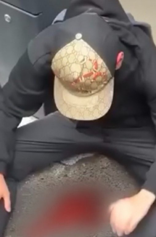 AlertesInfos's tweet photo. 🇫🇷 ALERTE - Touché par un tir de LBD, Maël, 16 ans, a PERDU L’USAGE DE SON ŒIL DROIT. (La Nouvelle République) https://t.co/yd9K25ewhQ