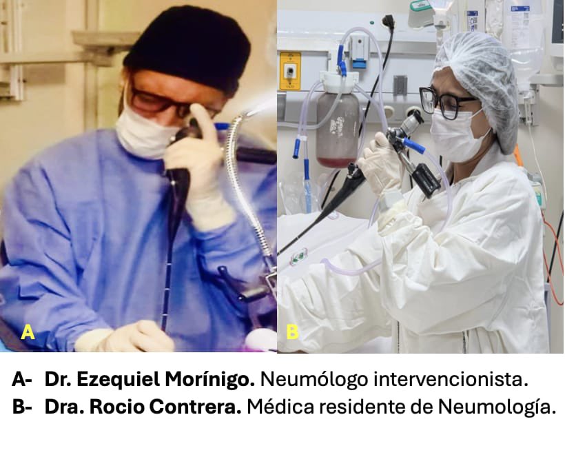 IPSParaguay's tweet photo. 🤝 El Hospital Central fortalece su Sección de Neumología Intervencionista con broncoscopías de alta complejidad en internación y UTI. Incorporamos al Dr. Ezequiel Morínigo, Fellow ALAT con formación en EE.UU., España, México y Argentina.
🔗 Leer más: https://t.co/VX8ws6JrWQ https://t.co/cPAySUf6Oh