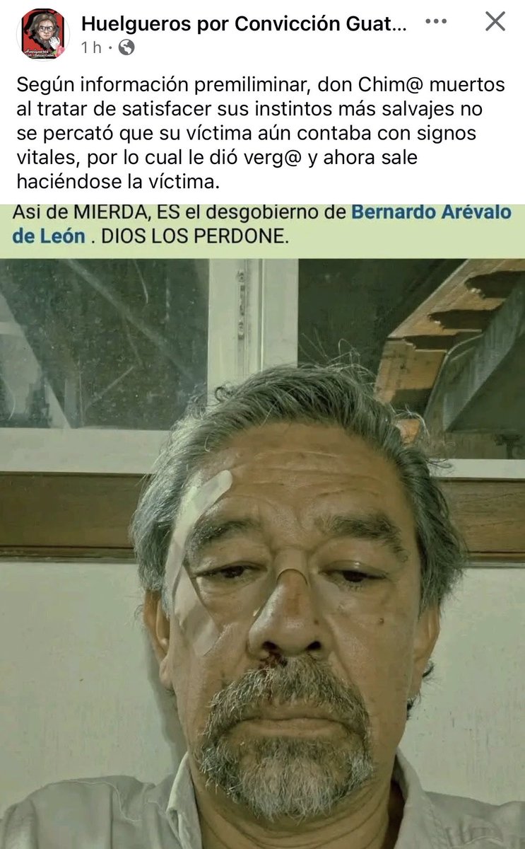 Eltibu2025's tweet photo. @Herman5818Pb Esta es la versión oficial no se dejen engañar ya que la víctima lo confino a un medio que termina en News https://t.co/07pvNn2TPV