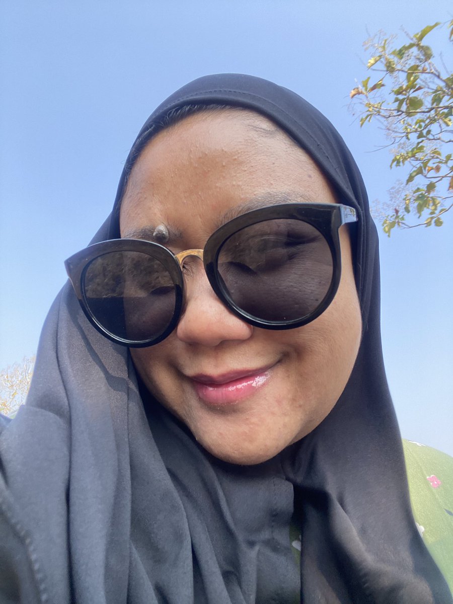 dittazharra's tweet photo. salah satu holy grailku buat atasi bruntusanku kemaren adalah serum exfo. 
makasih banget, meskipun gak instan tapi progresnya ada 😭￼ https://t.co/x7dkOONs9S