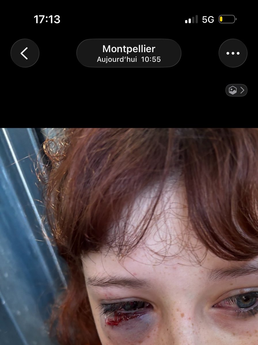 matindeneige's tweet photo. jtient a préciser que on était vrm pacifique hein et que c juste un crs qui est venu bousculer de derrières pour crée du mouvement puis ils nous ont chargé / regardez les heures : y’as vraiment 5 min d’écart sans débordement bref la matraque direct sur nous deux femmes évidement https://t.co/PCRIpCpwew