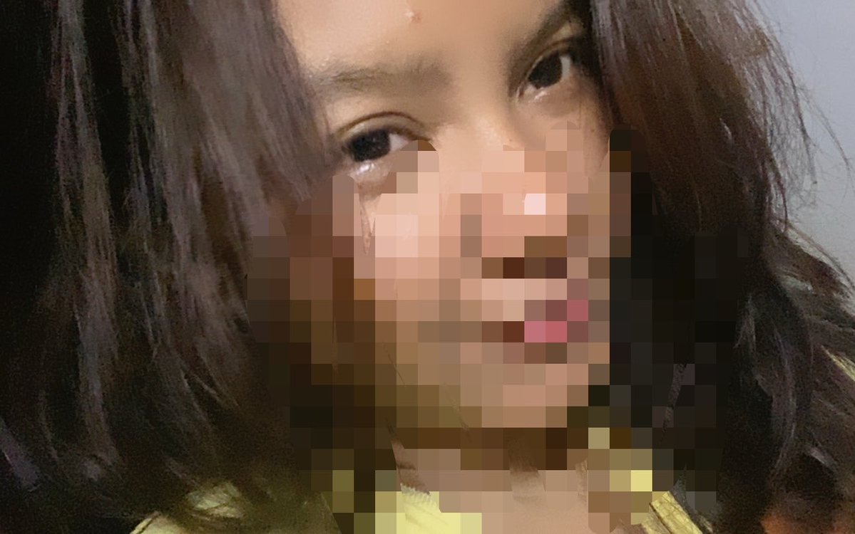 othgabriella's tweet photo. jerawat 🫠 https://t.co/rQxs06MNtR