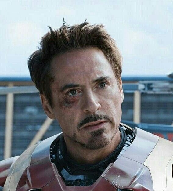 nnauuy_'s tweet photo. tony with an eye injury >>>> https://t.co/GbHt3f0ZKs