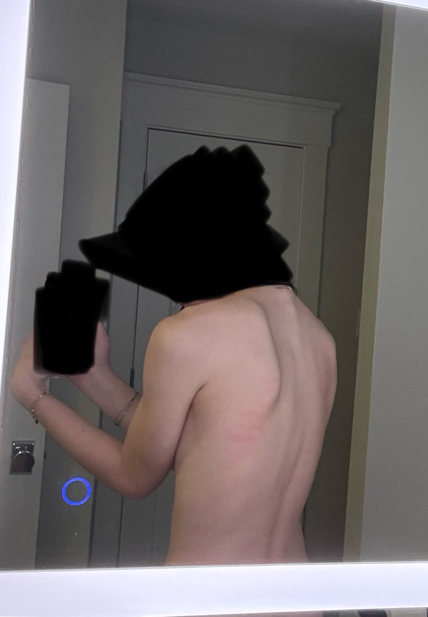 bbleeds4u's tweet photo. (bc) I feel like such normalspo like I’m not even underweight https://t.co/pai40knyze