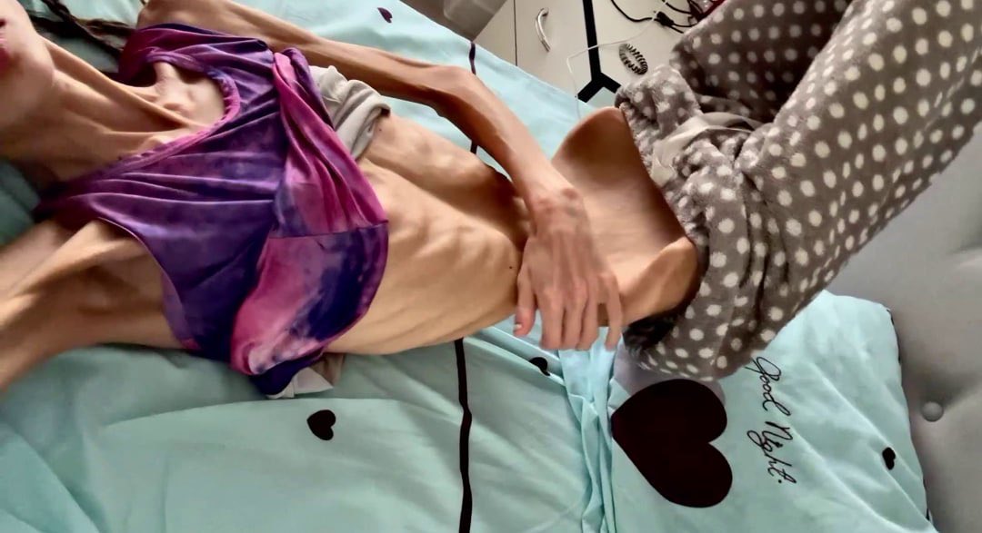 SkinnyAdmirer's tweet photo. #thinspo #thinspO0 #bonespo #bonesp0 #edtwt #anablur #edtw #twana #twed #edblur #edtblur #anatw #edrtwt #shedtwt https://t.co/Wl44MagndQ