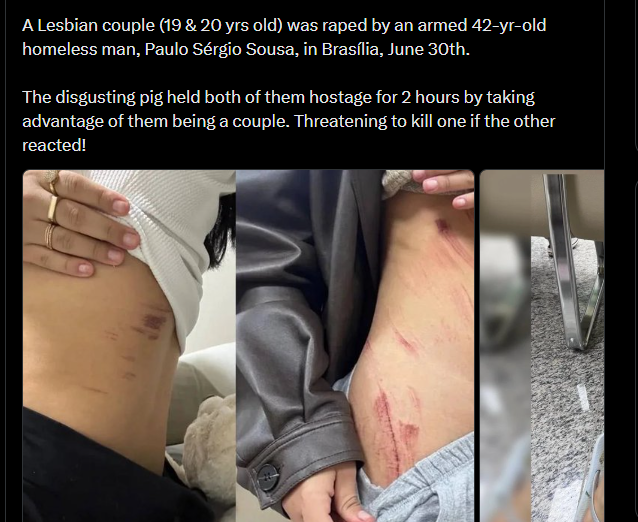 Nayori_Sober's tweet photo. Straight woman are not harmed by patriarchy because they like men, they are harmed by Patriarchy because they are Woman. 

And this is what LESBIANS suffer in Patriarchy. For not being JUST Woman but also for being a LESBIAN. 
Fuck yourself, you demonic Lesbophobic monstrosity! https://t.co/9L0uFXFM4i