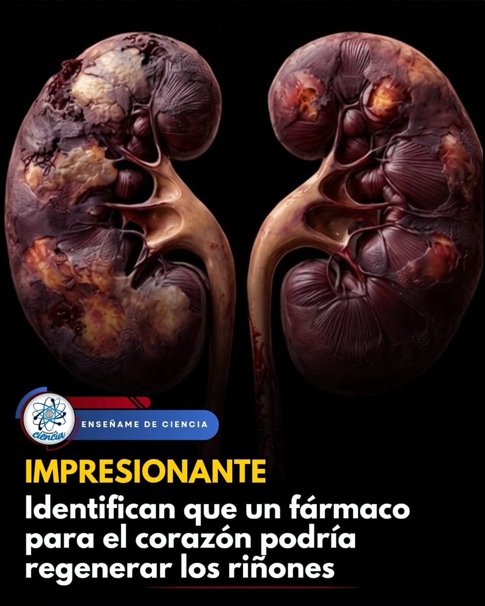 EnsedeCiencia's tweet photo. 🚨 Un equipo de investigadores de la Universidad de California en Los Ángeles (UCLA) ha descubierto que un fármaco previamente desarrollado por esta institución podría ser la clave para regenerar estos órganos. Hablamos del AD-NP1. Originalmente, este fármaco se diseñó para ayudar a reparar el tejido cardiaco después de un infarto. Pero, tras una investigación, se descubrió que también podría ser útil para reparar y regenerar el tejido de los riñones.