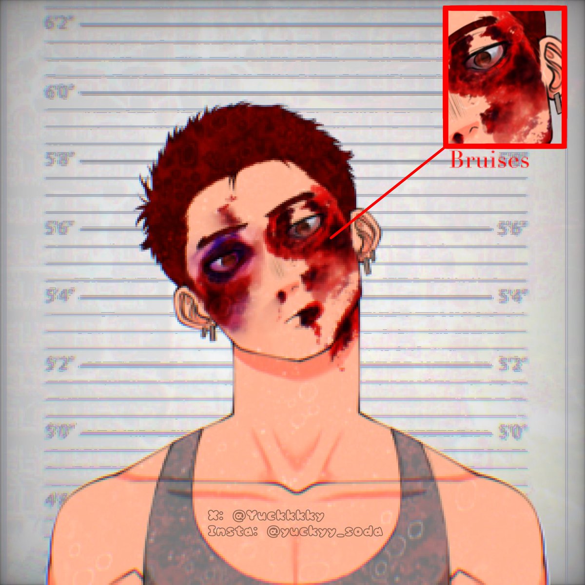Yuckkkky's tweet photo. 『𝕲𝖔𝖗𝖊𝖙𝖔𝖇𝖊𝖗』
      ↳𝖉𝖆𝖞 2

𝕻𝖗𝖔𝖒𝖕𝖙:  bruises 
#goretober #artwork #digitalartㅤ https://t.co/OIebkCVc5k