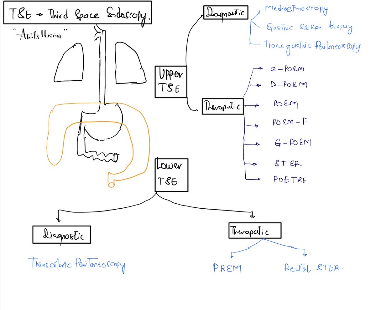 AnilcheswinK's tweet photo. From the lumen → to the submucosa → to the spaces beyond.
Third-space endoscopy represents an exciting frontier in minimally invasive therapeutic endoscopy.
#ThirdSpaceEndoscopy #AdvancedEndoscopy #TherapeuticEndoscopy #POEM #ESD #GPOEM #STER #InterventionalEndoscopy https://t.co/5SC71aTQNn