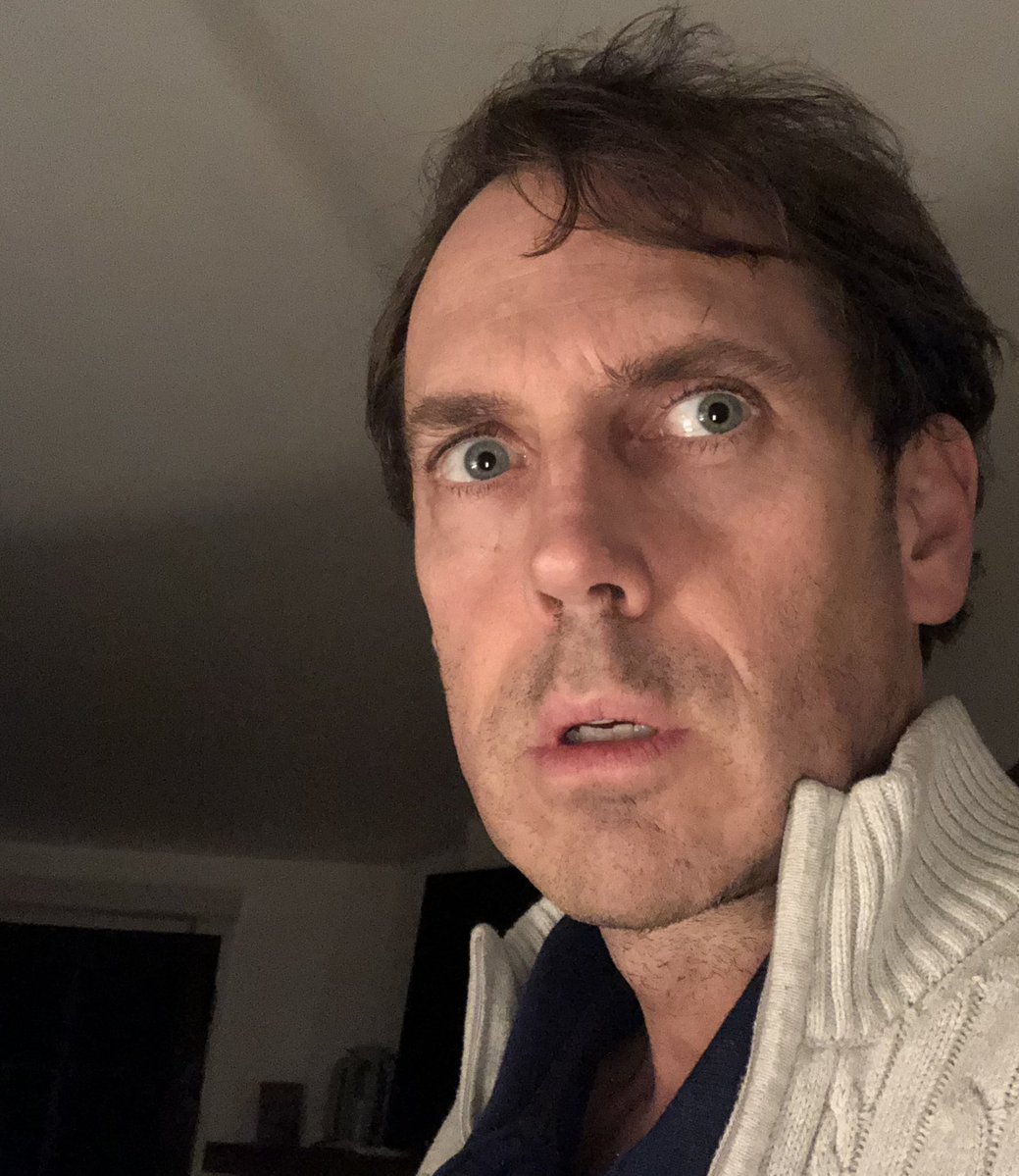 Clavuncular's tweet photo. Before &amp; After

Facial posture is the key https://t.co/MtLEfU4qbM