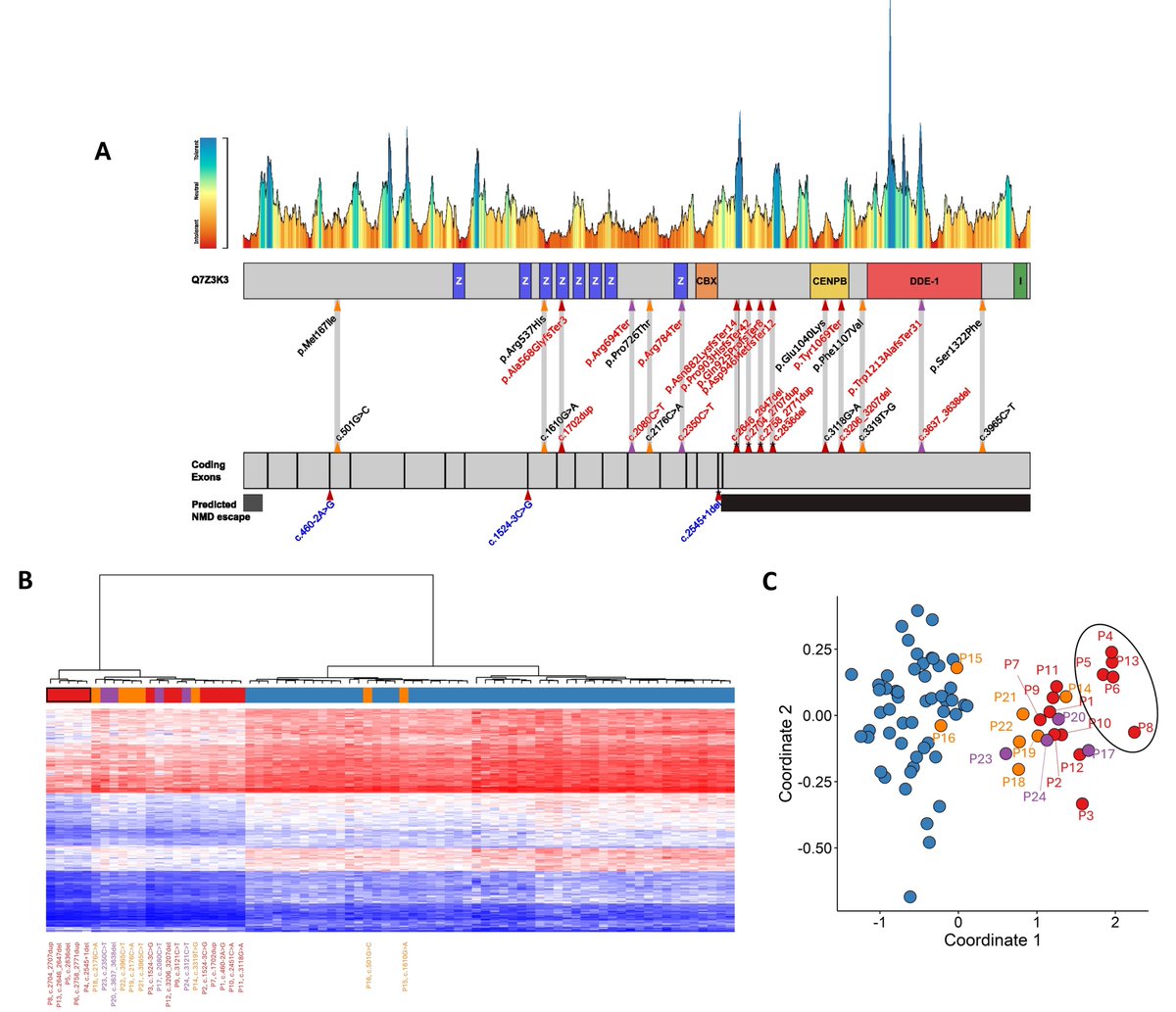 GIMJournal's tweet photo. A newly found #DNAmethylation episignature for White-Sutton syndrome improves diagnosis and helps reclassify uncertain POGZ variants, advancing precision care for rare neurodevelopmental disorders. https://t.co/Q9bDiXdj4n #GIMO #Epigenetics #POGZ #WHSUS #WhiteSuttonSyndrome https://t.co/WzhhipzBfd