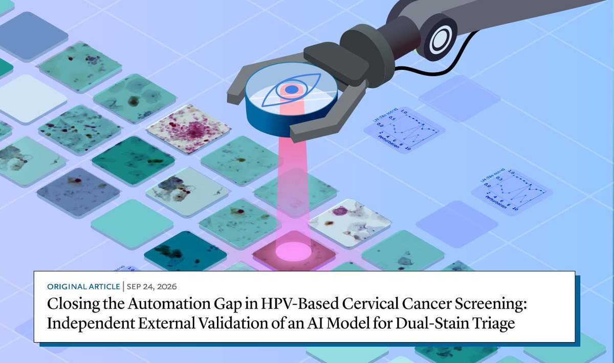 NEJM_AI's tweet photo. A new study explores the use of AI to automate p16/Ki-67 dual-stain cytology evaluation, a key step in triaging HPV-positive patients during cervical cancer screening. Learn more: https://t.co/rHShAfIDTU https://t.co/AGCTGFCPre